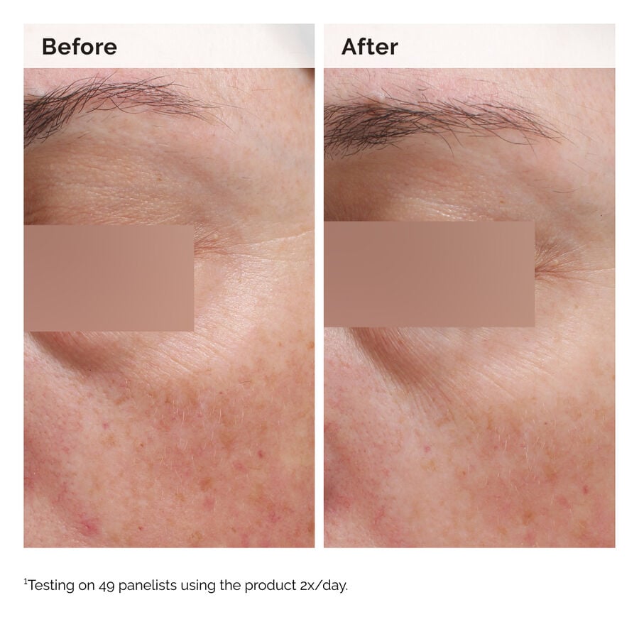 niacinamide-5-face-and-body-emulsion-i2 2024-08-23-ORD-Nia-5pct-Face-Body-B-A-Elasticity-Global-02-1x1.jpg