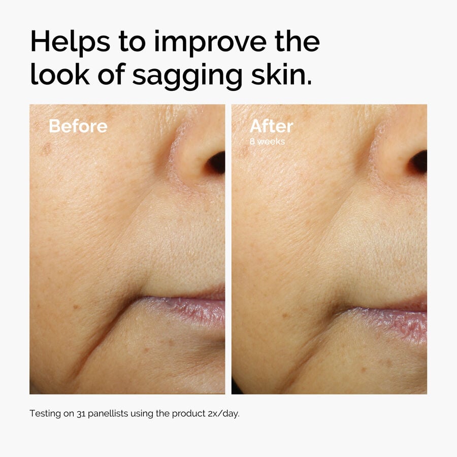 caffeine-3-escin-1-face-serum-j2 ord-caffeine-3pct-escin-1pct-face-serum-before-after-sagging.jpg