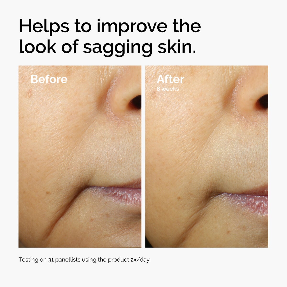 caffeine-3-escin-1-face-serum-j2 ord-caffeine-3pct-escin-1pct-face-serum-before-after-sagging.jpg