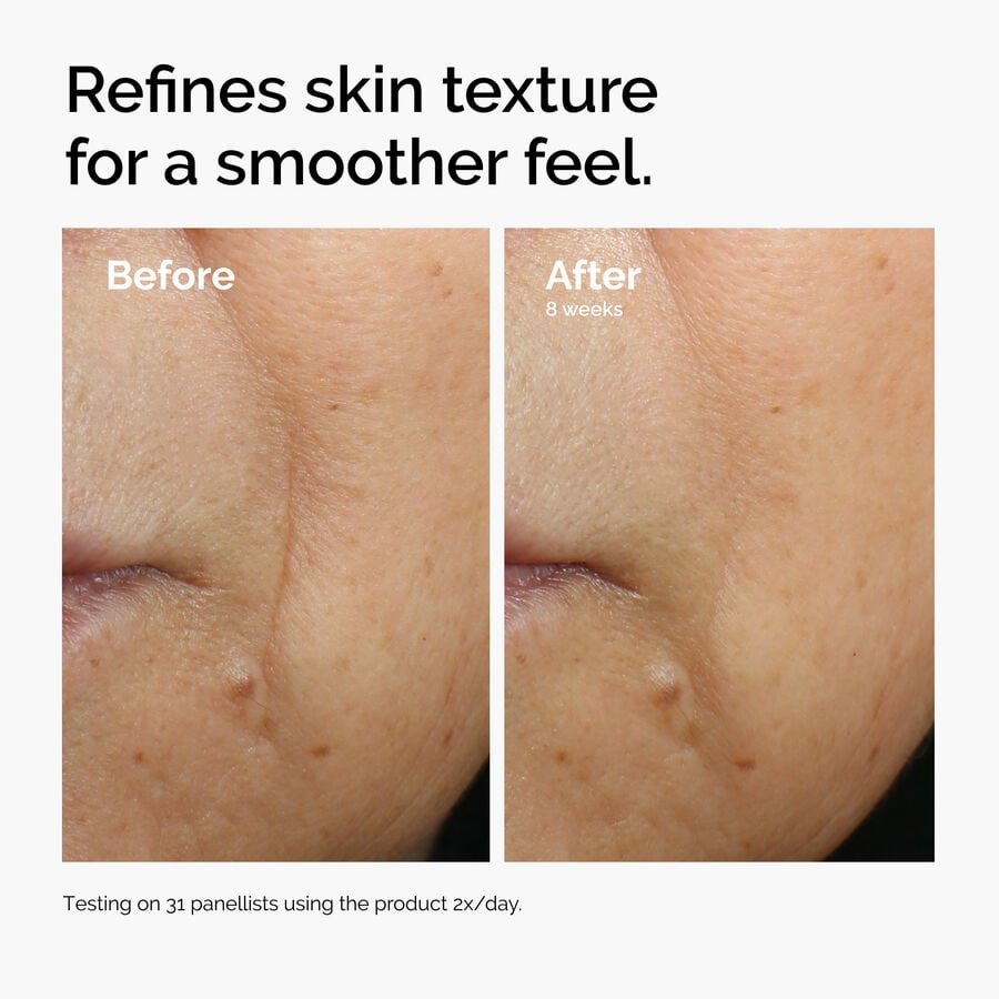 caffeine-3-escin-1-face-serum-j2 ord-caffeine-3pct-escin-1pct-face-serum-before-after-texture.jpg