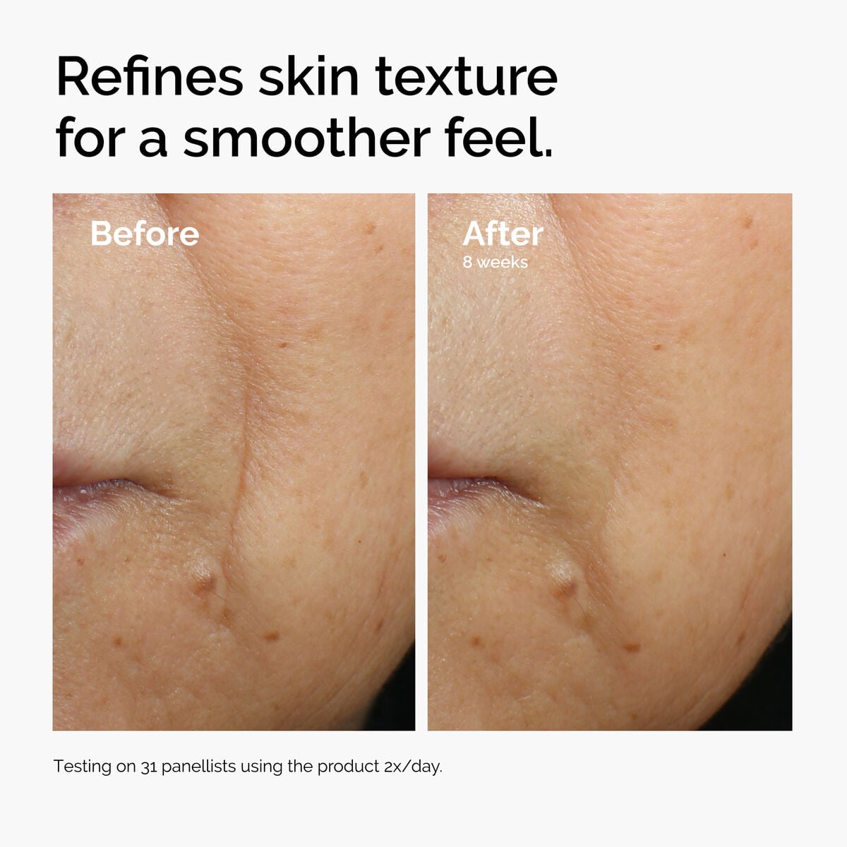caffeine-3-escin-1-face-serum-j2 ord-caffeine-3pct-escin-1pct-face-serum-before-after-texture.jpg