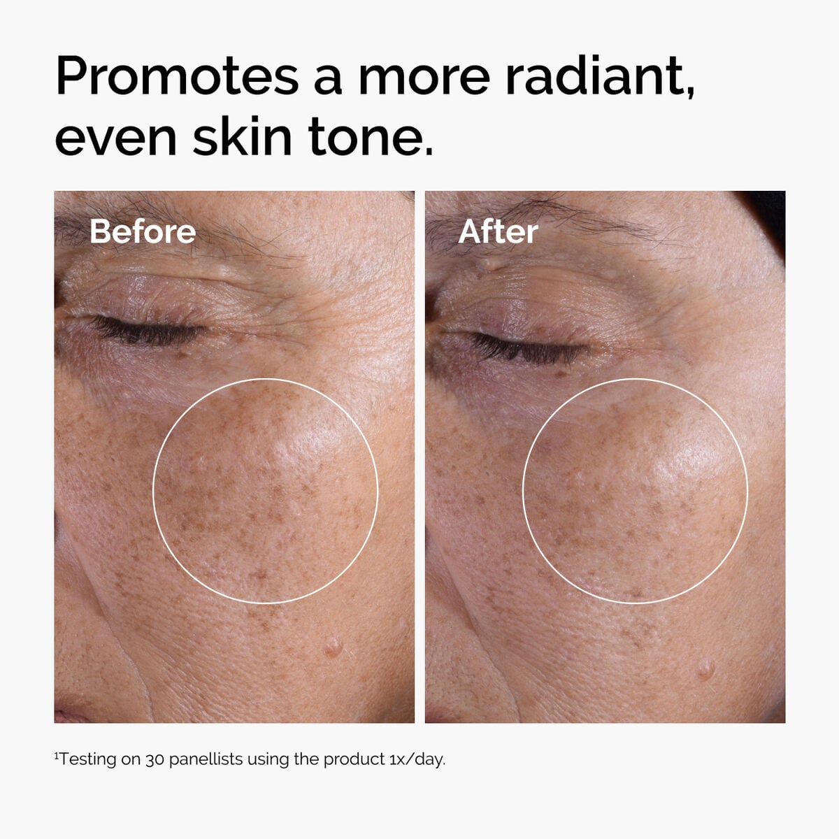 glycolic-acid-7-exfoliating-toner-t0 ord-glycolic-before-after-radiance.jpg