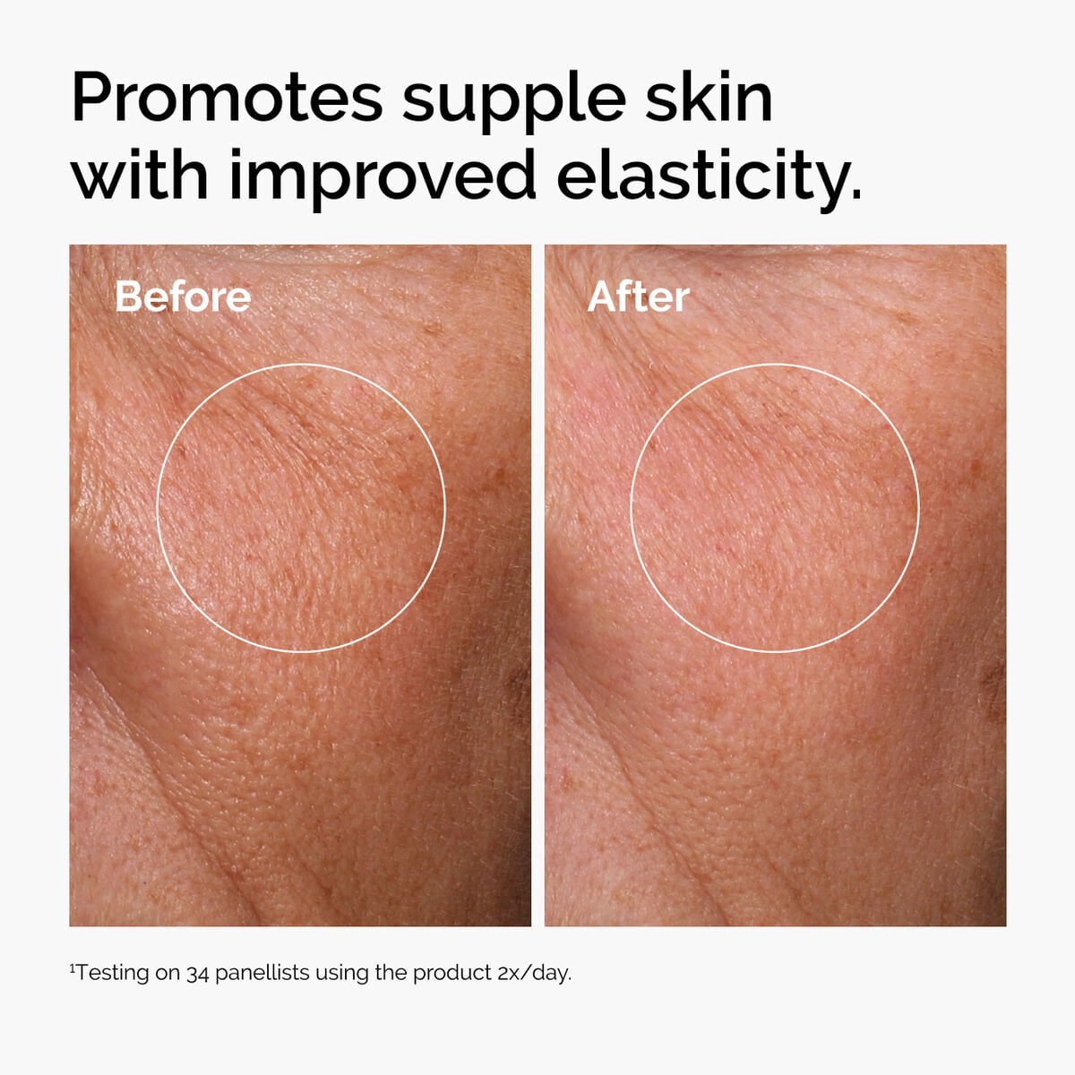 hyaluronic-acid-2-b5-with-ceramides-v6 ord-hyaluronic-acid-2pct-b5-hydrating-serum-before-after-elasticity.jpg